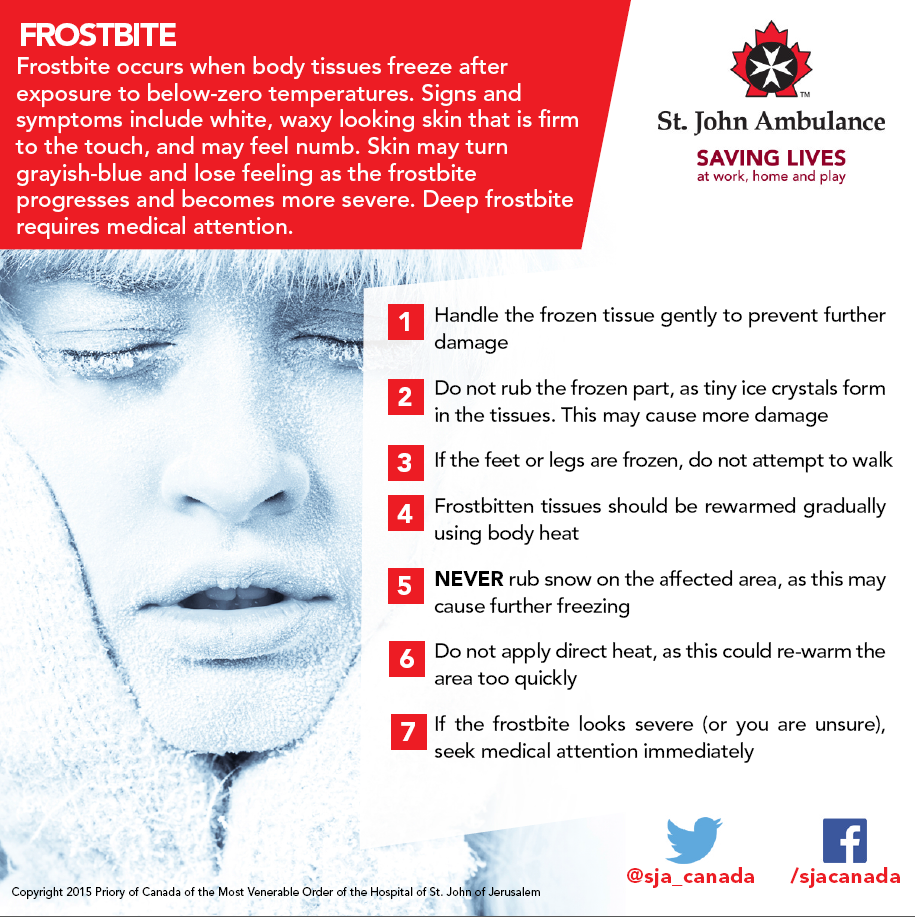 Dealing with Frostbite - SwiftCurrentOnline.com - Local news, Weather ...